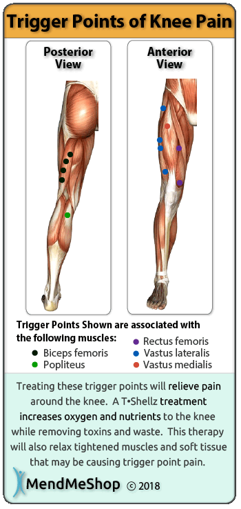 Body Trigger Points Chart