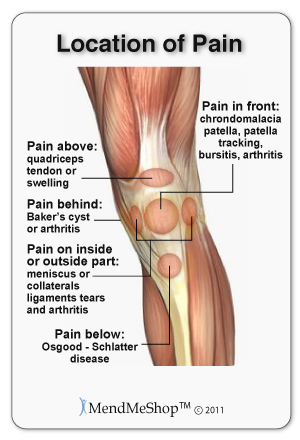Knee pain can occur at several places in the joint depending on the injury or condition.