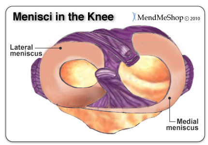 The lateral (outside of the knee) and medial (inside of the knee) menisci.