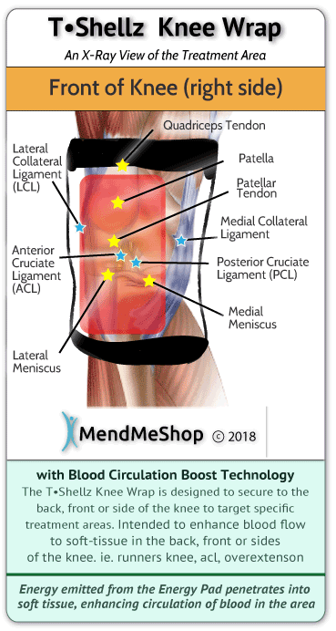 MendMeShop KneeWrap speeds the healing of MCL injuries and tears