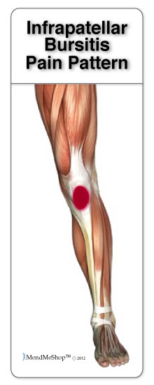 La douleur autour et sous la rotule est généralement causée par une bursite prépatellaire ou infrapatellaire.