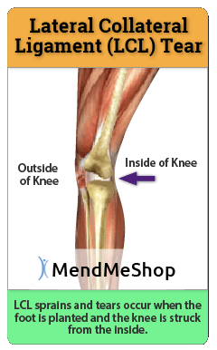 how the LCL is injured